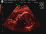 Isabela 30 semanas