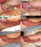 Leg collage 10-4-07