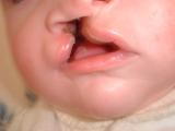 To prevent messy clean-ups when your baby spits up or has a wet burp, you might want to place a towel or bib under your baby's chin or on your shoulder. You may also experiment with different positions for burping that are comfortable for you and your baby.