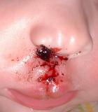 The day after close up