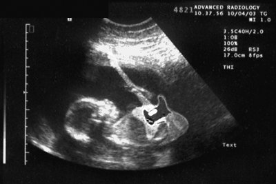 sonogram2.jpg