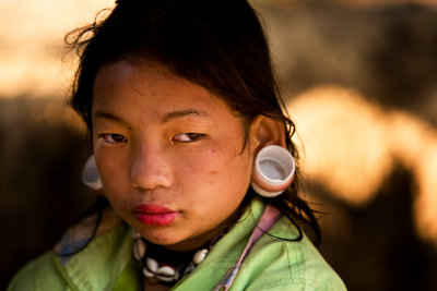 Karen hill tribe girl with large perforation in ear-lobe