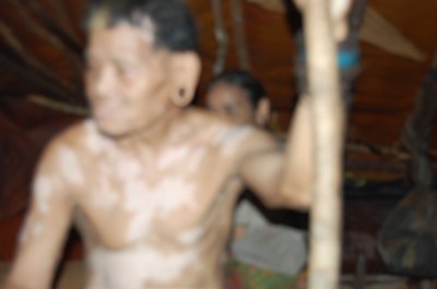 Dominic brought him to Limbang Hosp last month. Has poor eyesight.