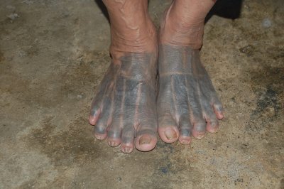 Tattoo all over the body.
