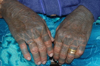 She said it is very painful doing the tattoo the old way.
