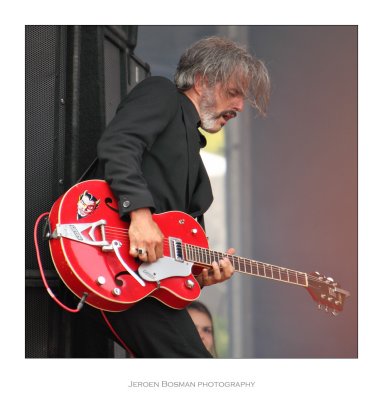Triggerfinger