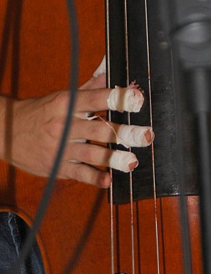 Clayton's bloody fingers and strings, from 2 days of Bluegrass Bass pickin!  Gota lov it!!