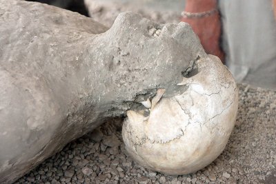 Roman victim from Vesuvio's ashes