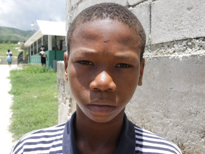 Alec a Haitian Boy In Need of Jaw Surgery ... Please Help!!!!