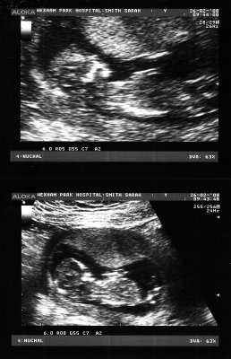 All Edwards Scan photos