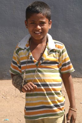 Boy with a Broken Arm Bijapur