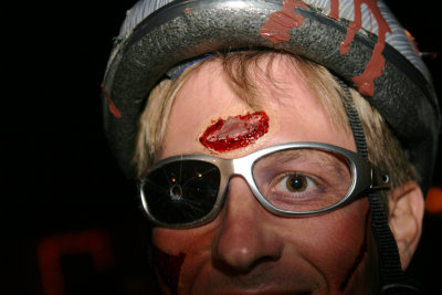 glass in head