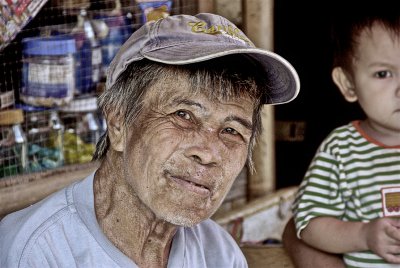 facial disease -with his grandchild