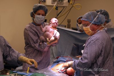 Cesarean Birth