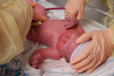 First checkup