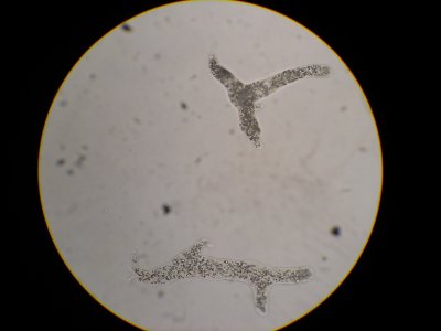 Protozoa (Protozoer)