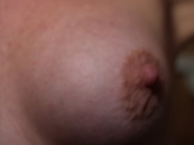 Breast Breast 059
