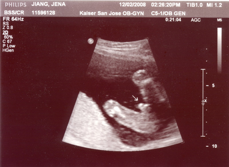 ultrasound_1.jpg
