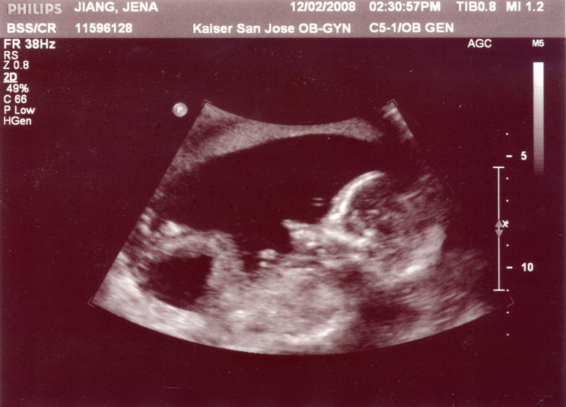 ultrasound_3.jpg