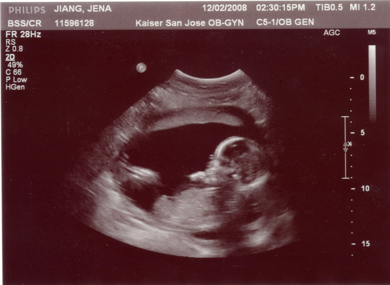 ultrasound_4.jpg