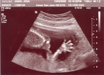 ultrasound_2.jpg