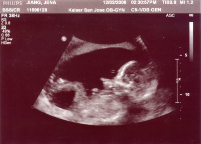 ultrasound_3.jpg