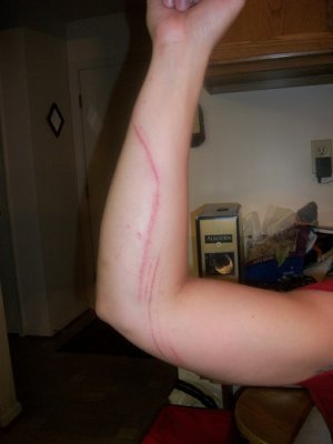 Proud of my wound