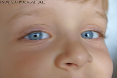 25