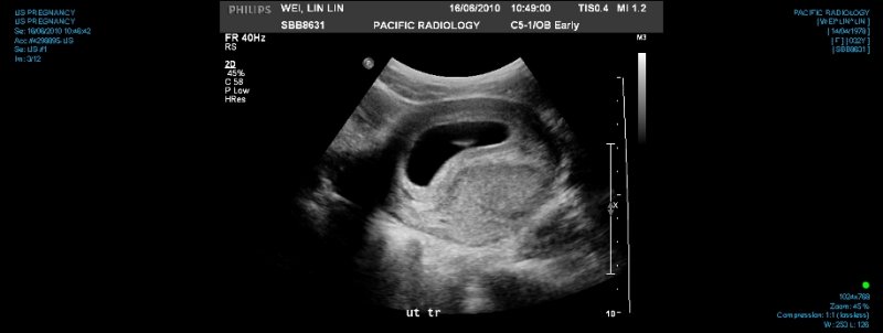 US PREGNANCY 0003.jpg