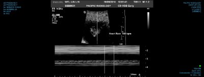 US PREGNANCY 0009.jpg