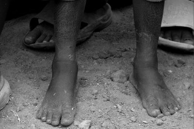 Orphan's feet