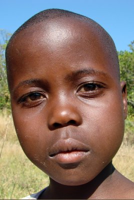 Zimbabwe child