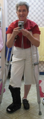 Broken Ankle March 2009