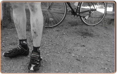 Bruised Cyclist's Legs