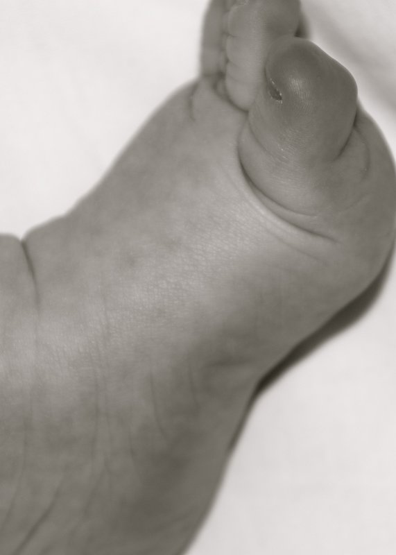 Foot
