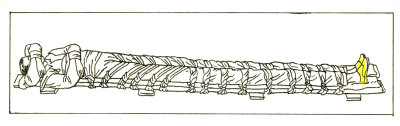 Stilted Mans Splints