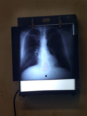 X-Rays Display