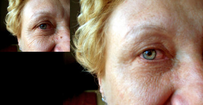 Enhancements - Remove Wrinkles