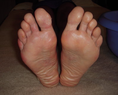 feet immediately post race (well 195 km of the race).  Not ONE blister or even hotspot!