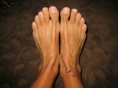 feet 5 days after the race.  The ankle swelling is significantly down.