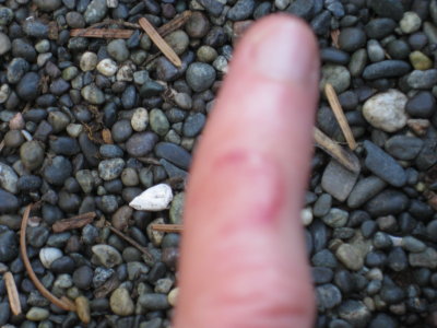 I hope this is not lymmes disease