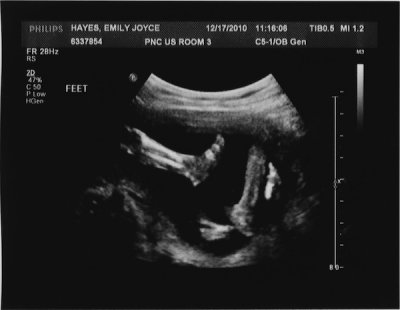 12.17.10::Legs!