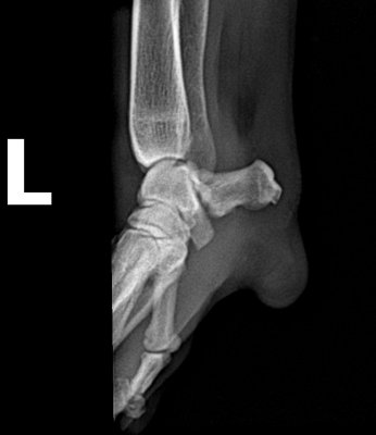 FRONT EXTREMITY - LATERAL1.jpg