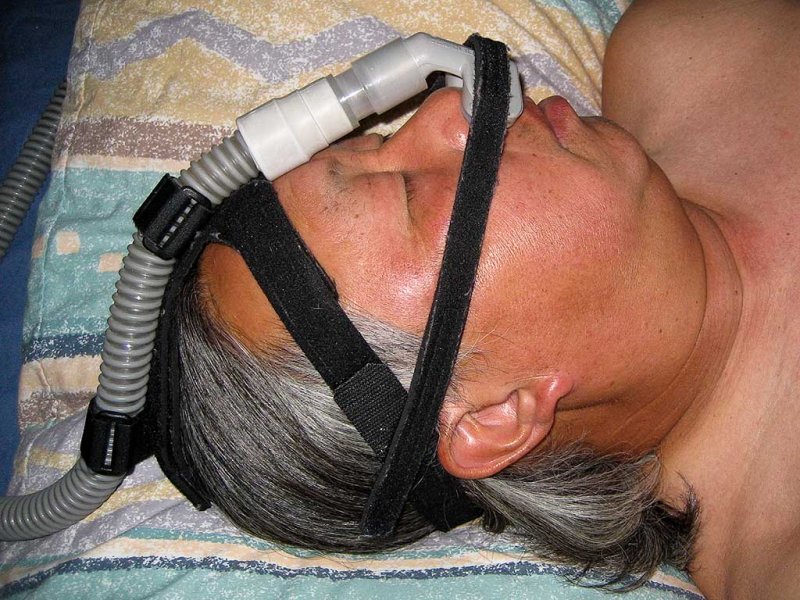 ADAM (Airway Delivery and Management) Circuit Nasal Pillow CPAP Mask with Headgear