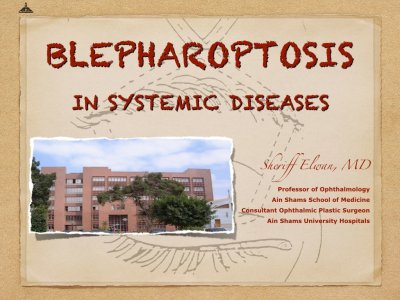 Blepharoptosis in Systemic Disease