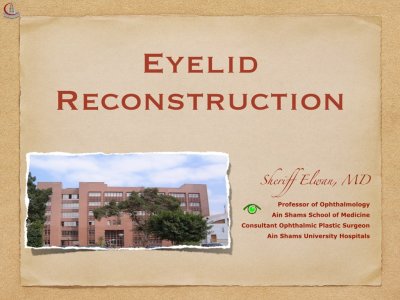 Eyelid Reconstruction.001.jpeg