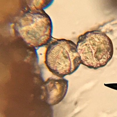 Zoomed in on sage pollen (>400x)