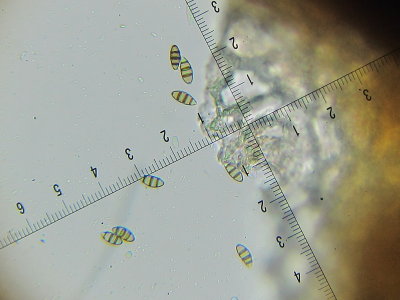 Discostroma corticola 002 conidia 7-4-2016.JPG