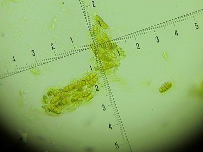 Pezicula houghtonii 002  asci & spores in Melzers x400 17-4-2016.JPG