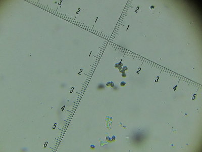 Trechispora fastidiosa 002 verrucose spores 2016-11-5.JPG